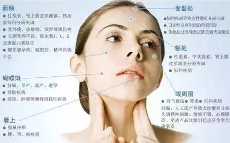 成都妇科医生：女人脸上长斑小心是得了妇科病